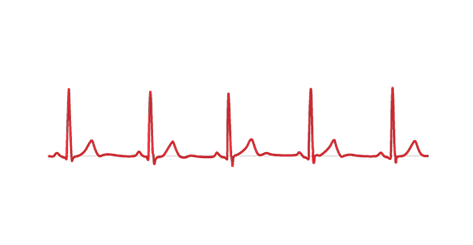 BTL_Cardiology_Excelent-signal-quality2