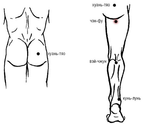 китайская акупунктура