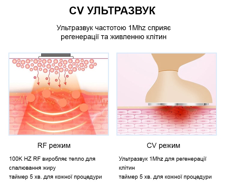 ultrazvukovoy-stimulyator-5-v-1-s-funktsiey-rf-liftinga-dlya-svetoterapii-i-pokhudeniya-9u.jpg