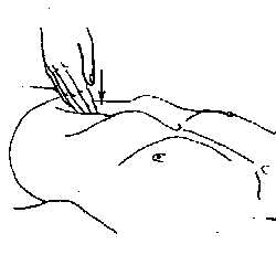 Некоторые приёмы обдавливания внутренних органов, применяемые в методе висцерального массажа (висцеральной хиропрактики)